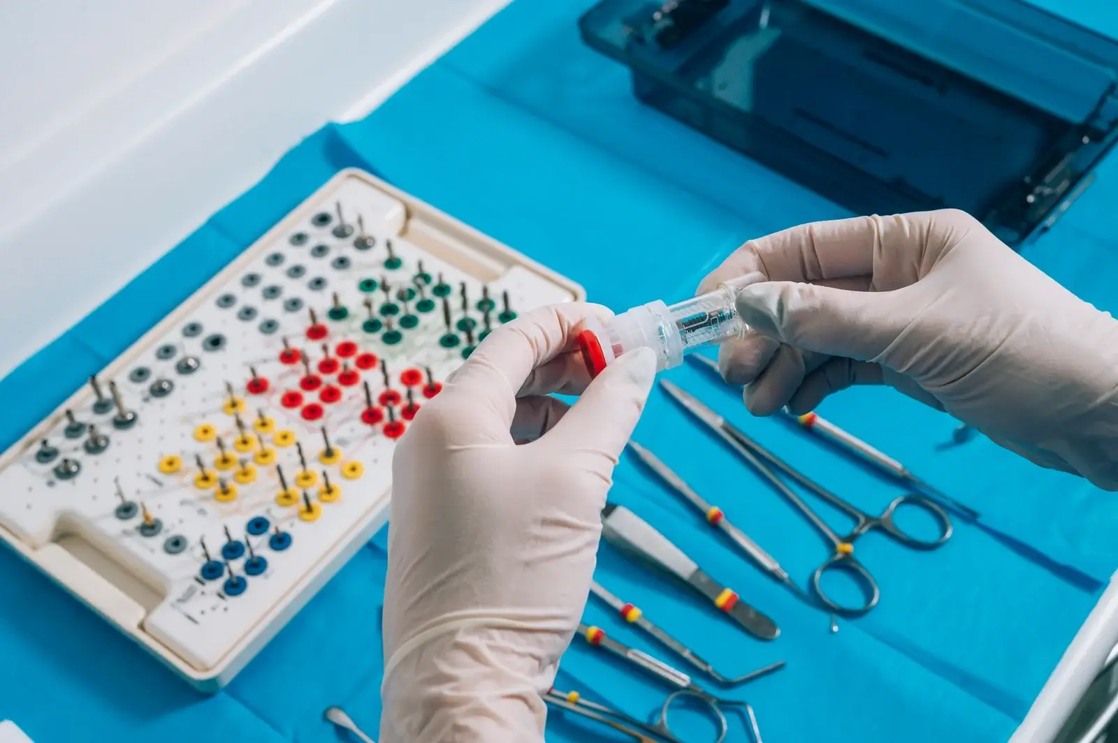 hand-holding-a-dental-implant (1)